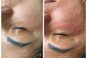 Имгрунт Анна Романовна — Портфолио №3