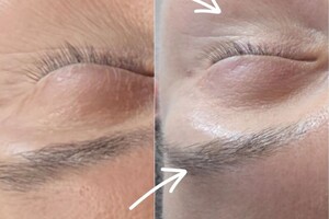 Ким Наталья Борисовна — Микротоки это популярная косметологическая процедура, которая использует слабые электрические импульсы для стимуляции... — Портфолио №5