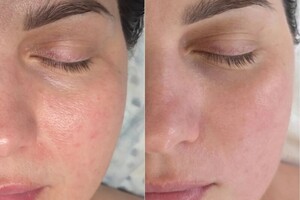 Ким Наталья Борисовна — Профессиональный уход за лицом включает в себя применение профессиональной космецевтики для улучшения состояния кожи... — Портфолио №6