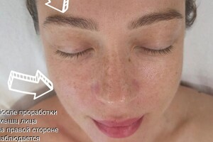 Ким Наталья Борисовна — Видимое изменение контура и овала правой стороны лица, тогда как левая сторона лица еще не прорабатывалась — Портфолио №7