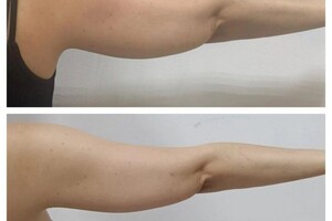 Коваленко Ольга Анатольевна — Результат после одного сеанса.1час — Портфолио №2