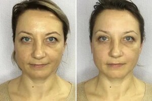 Коваленко Ольга Анатольевна — Результат после первого сеанса — Портфолио №3