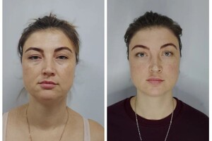 Коваленко Ольга Анатольевна — Во время массажа проработана шейно-воротниковая зона для расслабления мышц шеи и трапеции,что запускает хороший... — Портфолио №8