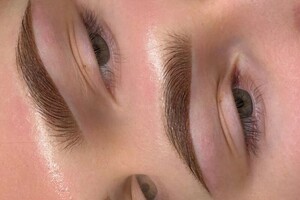 Ковалева Екатерина Вячеславовна — Сразу после процедуры — Портфолио №16