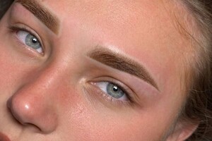 Ковалева Екатерина Вячеславовна — Сразу после процедуры — Портфолио №17