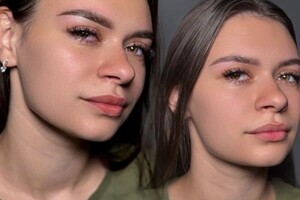 Ковалева Екатерина Вячеславовна — Заживший пм через год и сразу после обновления — Портфолио №18