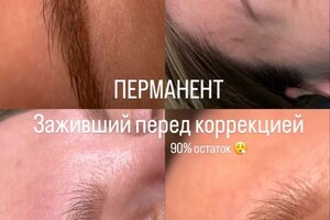 Ковалева Екатерина Вячеславовна — Перед коррекцией зажившие — Портфолио №20