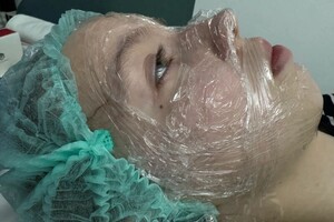 Кулик Мария Викторовна — Ультразвуковая чистка лица — Портфолио №10