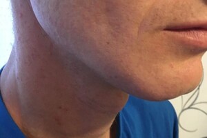 Максимова Ольга Анатольевна — Шугаринг бороды у мужчины — Портфолио №40