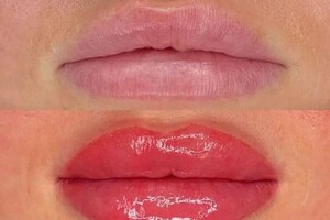 Найман Эмма Игоревна — Коррекция губ с помощью перманентного макияжа губ. Стойкость цвета на 3 года — Портфолио №1