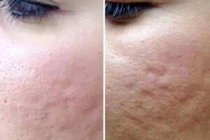 Беляевская Яна Вячеславовна — Микронидлинг — Портфолио №3