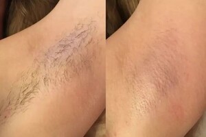 Беляевская Яна Вячеславовна — Шугаринг — Портфолио №7