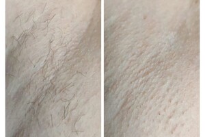 Беляевская Яна Вячеславовна — Восковая депиляция — Портфолио №8