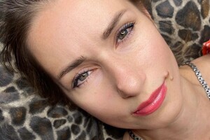 Попова Наталья Александровна — Заживший результат перед коррекцией — Портфолио №125