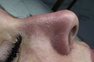 Самохвалова Алиса Алексеевна — После — Портфолио №89