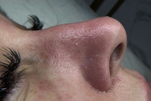 Самохвалова Алиса Алексеевна — После — Портфолио №90