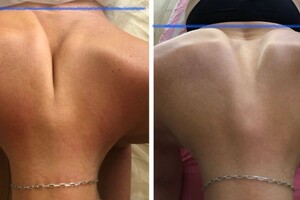 Шекемова Виктория Николаевна — Солярно фасциальная практика — Портфолио №11