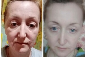 Шекемова Виктория Николаевна — Фейспластика — Портфолио №14