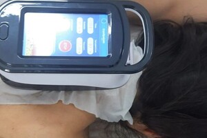 Сухомлинова Елена Владимировна — Криолиполиз, устранение холки — Портфолио №3