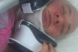 Сухомлинова Елена Владимировна — Криолиполиз, коррекция подбородка — Портфолио №4