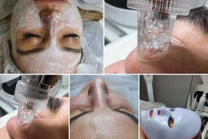 Сухомлинова Елена Владимировна — Аппаратная чистка; Гидропилинг+фоно; форез+фарфоровая; куколка+криотерапия всё включено !; Лэд терапия(маска) в... — Портфолио №9