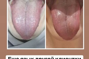 Тарасова Наталья Александровна — Девушка забеременела после 5 лет тщетных попыток — Портфолио №11