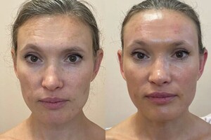 Янда Оксана Михайловна — Скульптурный массаж лица — Портфолио №10