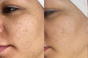 Янда Оксана Михайловна — Королевская чистка лица — Портфолио №2