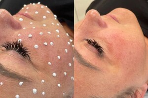 Янда Оксана Михайловна — Ультразвуковая чистка лица + маска — Портфолио №3