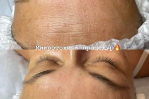 Янда Оксана Михайловна — Микротоковая процедура — Портфолио №4