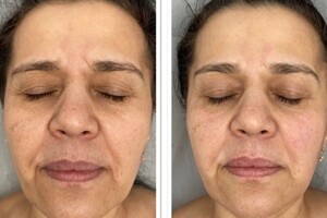 Янда Оксана Михайловна — Классический массаж лица — Портфолио №6