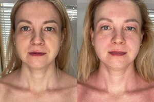 Янда Оксана Михайловна — Лимфодренажный массаж лица — Портфолио №7