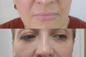 Зальхов Алла Игоревна — Татуаж губ — Портфолио №11