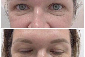 Зальхов Алла Игоревна — Обновление и коррекция татужа бровей — Портфолио №7