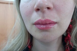 Зальхов Алла Игоревна — Татуаж губ — Портфолио №9
