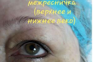 Межресничка — Гречанникова Мария Игоревна