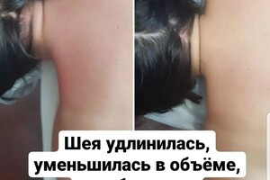 Миофасциальный массаж тела, \