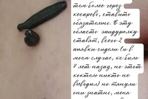 4 постановка пиявок из курса общего востановления+ востановление после родов и кс. — Бетина Виктория Сергеевна