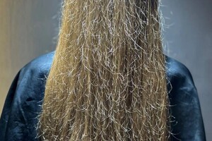 Фото до процедуры — Черникова Елена Викторовна
