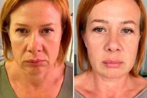 Массаж лица 7 сеансов — Макридина Елена Владимировна