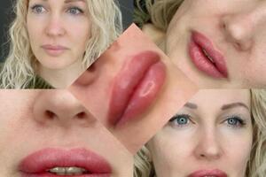 Перманентный макияж губ сразу после йпроцедуры. Длительность процедуры 2часа. Полный результат через один месяц. Цвет... — Галиева Анися Азатовна