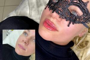 Увеличение губ — Сергеева Яна Игоревна