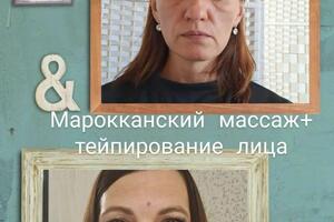 Марокканский массаж (40 мин)+ тейпирование лица. Результат 2 процедур — 