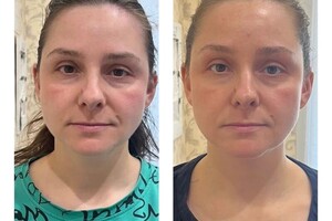 4 сеанса миофасциального массажа лица. — Малюшова Наталья Вадимовна