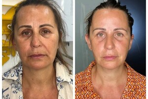 Миофасциальный массаж лица это специализированная техника массажа, направленная на улучшение состояния мышц и фасций... — Малюшова Наталья Вадимовна
