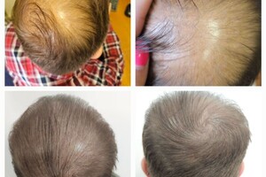 имитация густоты волос у мужчины — Лебедева Ольга Сергеевна