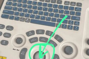 Юрлов Алексей Игорьевич — Ремонт Трэкбола — Портфолио №30