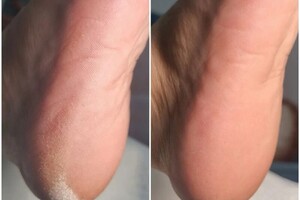 Никифорова Оксана Андреевна — Комбинированный педикюр — Портфолио №7