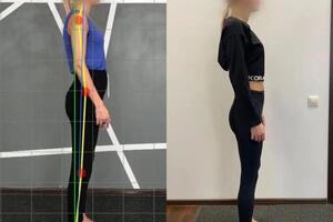 Коррекция осанки, работа с диафрагмой, восстановление мышц пресса и тазового дна — Бакланова Дарья Александровна