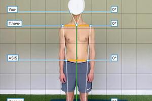Диагностика осанки — Кулаков Арсений Тиерриевич